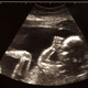 Image for article titled Fewer NBA Players Choosing To Learn Unborn Child’s Position